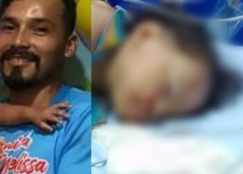 Pai espanca filha de 2 anos por não aceitar fim de relacionamento com a companheira em Manaus