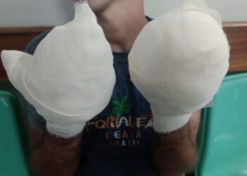 Traficantes arrancam dedos de suposto ladrão durante sessão de tortura em Manaus