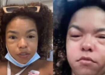 Jeniffer Nascimento revela ter sofrido com reação alérgica por lagosta: ‘Desesperador’