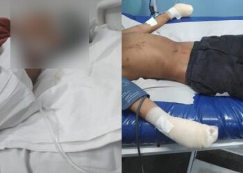 Facção criminosa decepa oito dedos de adolescente em Manaus