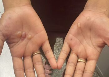 Mulher é presa por agredir e queimar menina no Centro de Manaus; IMAGENS FORTES