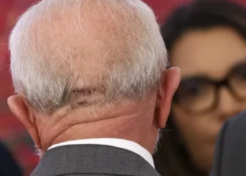 Lula faz exames em Brasília e apresenta quadro estável
