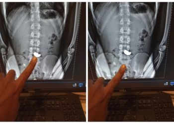 Homem engole corrente de ouro para escapar de flagrante