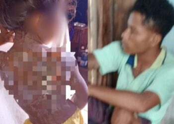 Homem é preso após queimar criança de 6 anos com mingau quente em aldeia no AM
