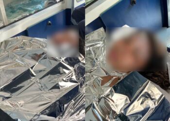Grávida de 21 anos é identificada como vítima de incêndio no Distrito Industrial e está internada com queimaduras