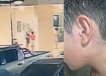 Criança tem tímpano perfurado após tapas de oficial de justiça em Manaus