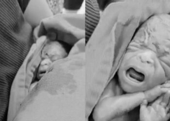 Bebê declarado morto em maternidade do Acre e encontrado vivo dentro do caixão morre na UTI neonatal