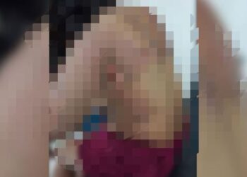 Homem ateia fogo em ex-mulher e filho por não aceitar separação em Parintins