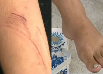 Mulher pula do 2º andar com filhos para fugir de ataque do marido
