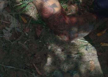 Homem tem rosto desfigurado por tiros e polícia investiga ligação com outro homicídio em Manaus